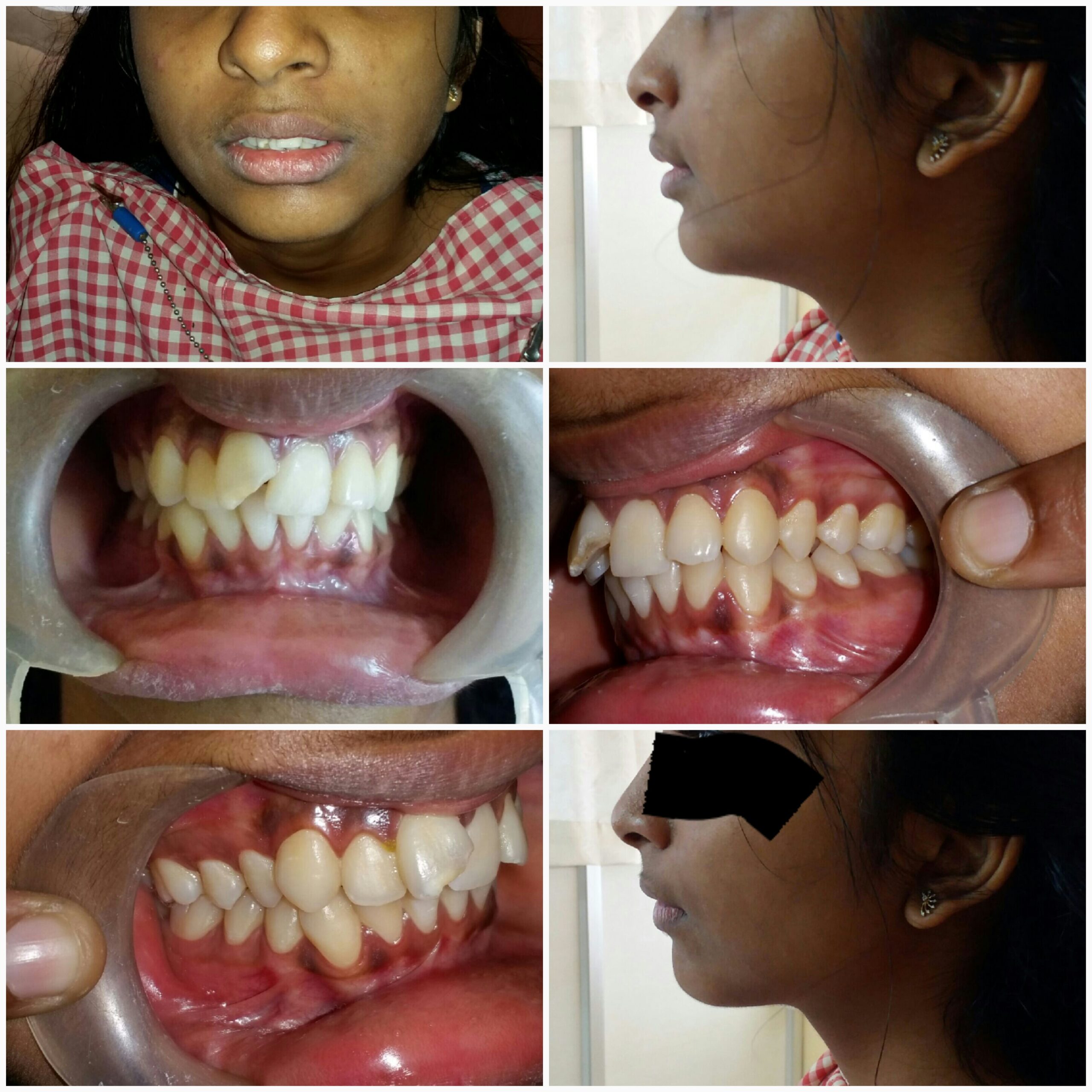 Before treatment