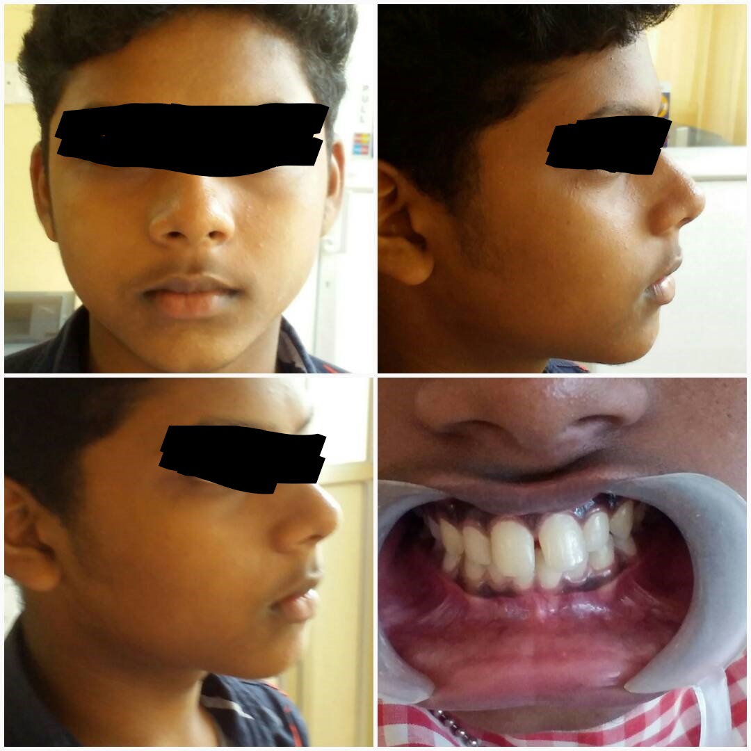 Before treatment
