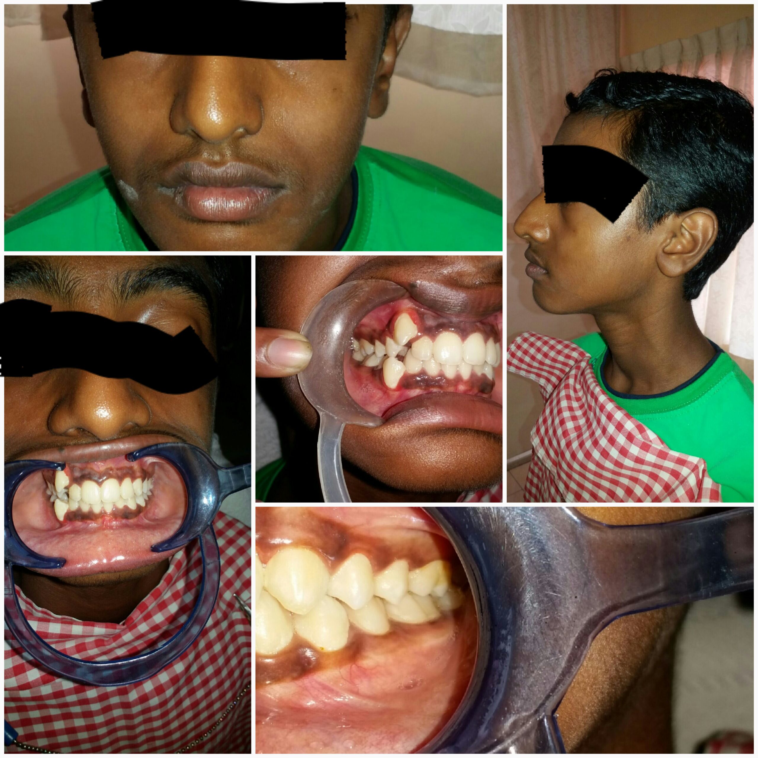 Before treatment
