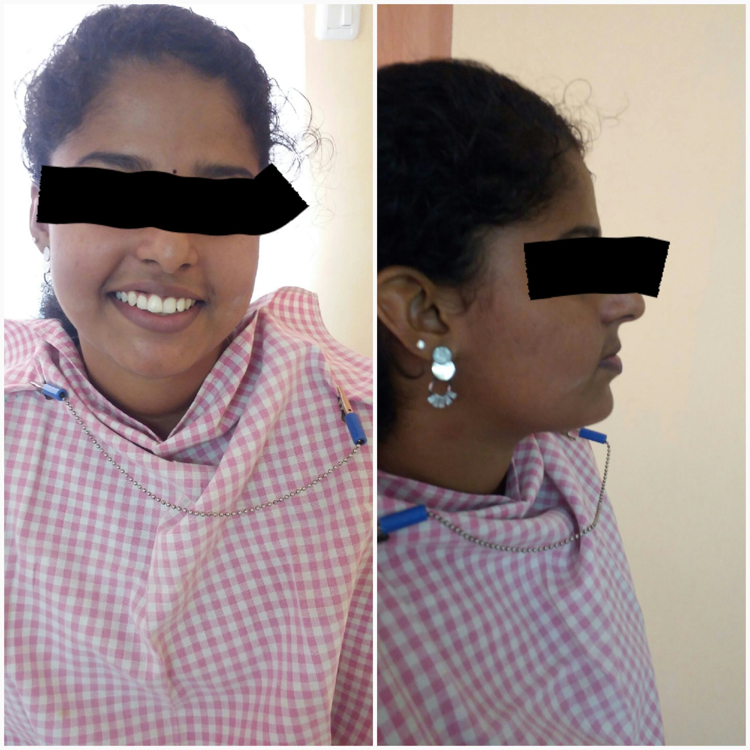 Before treatment
