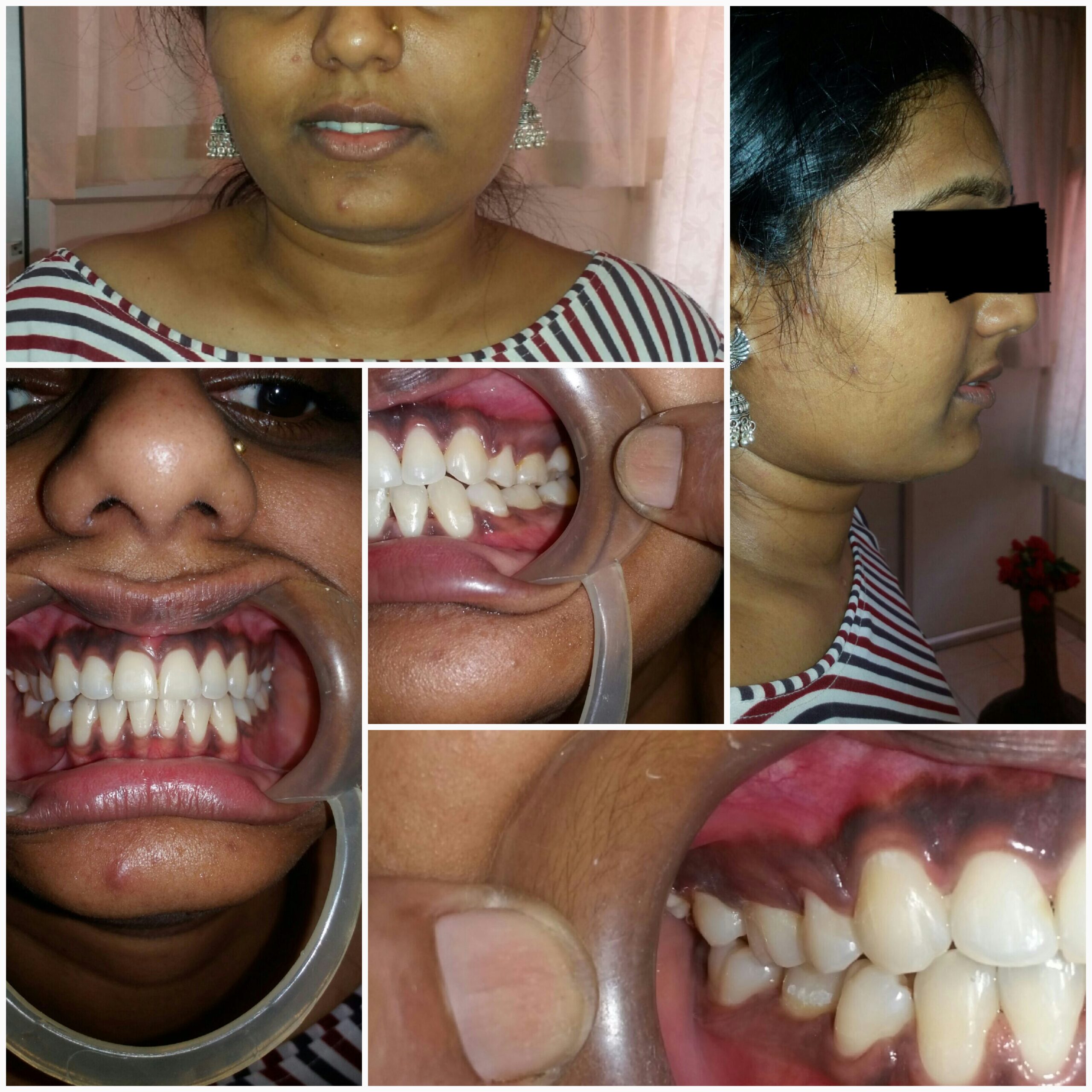After treatment