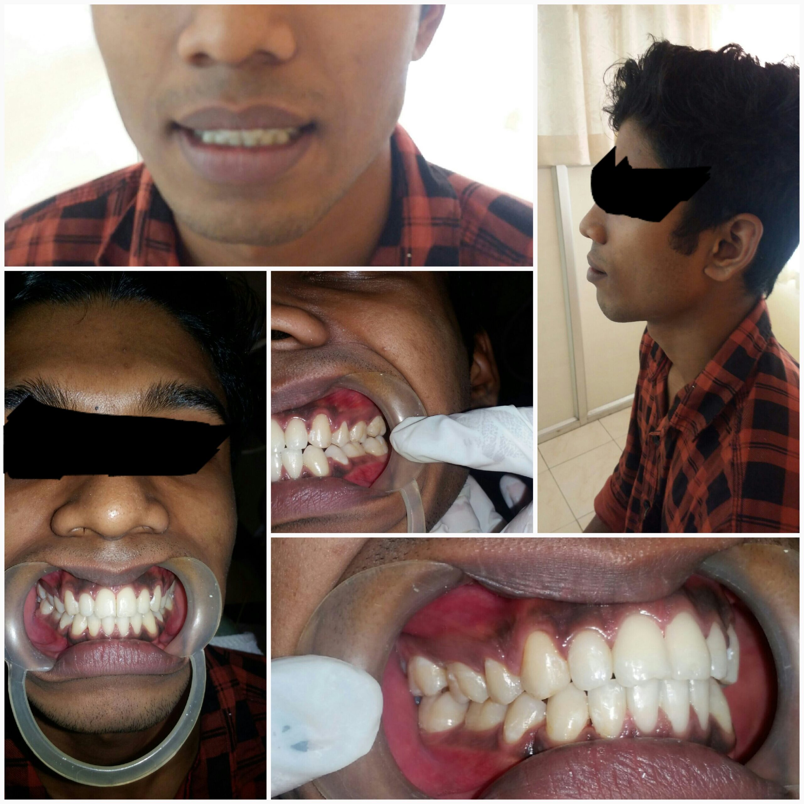 After treatment