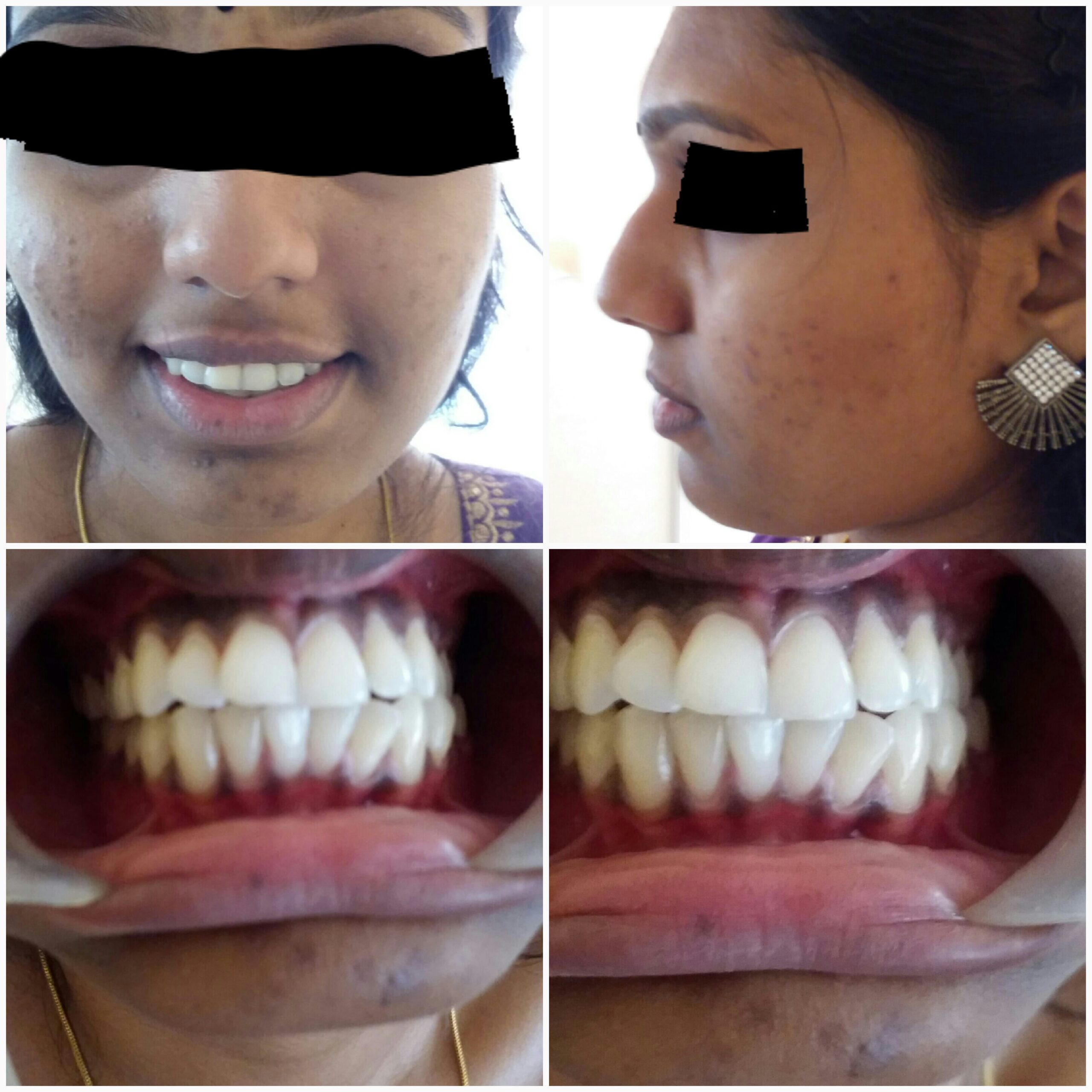 Before treatment