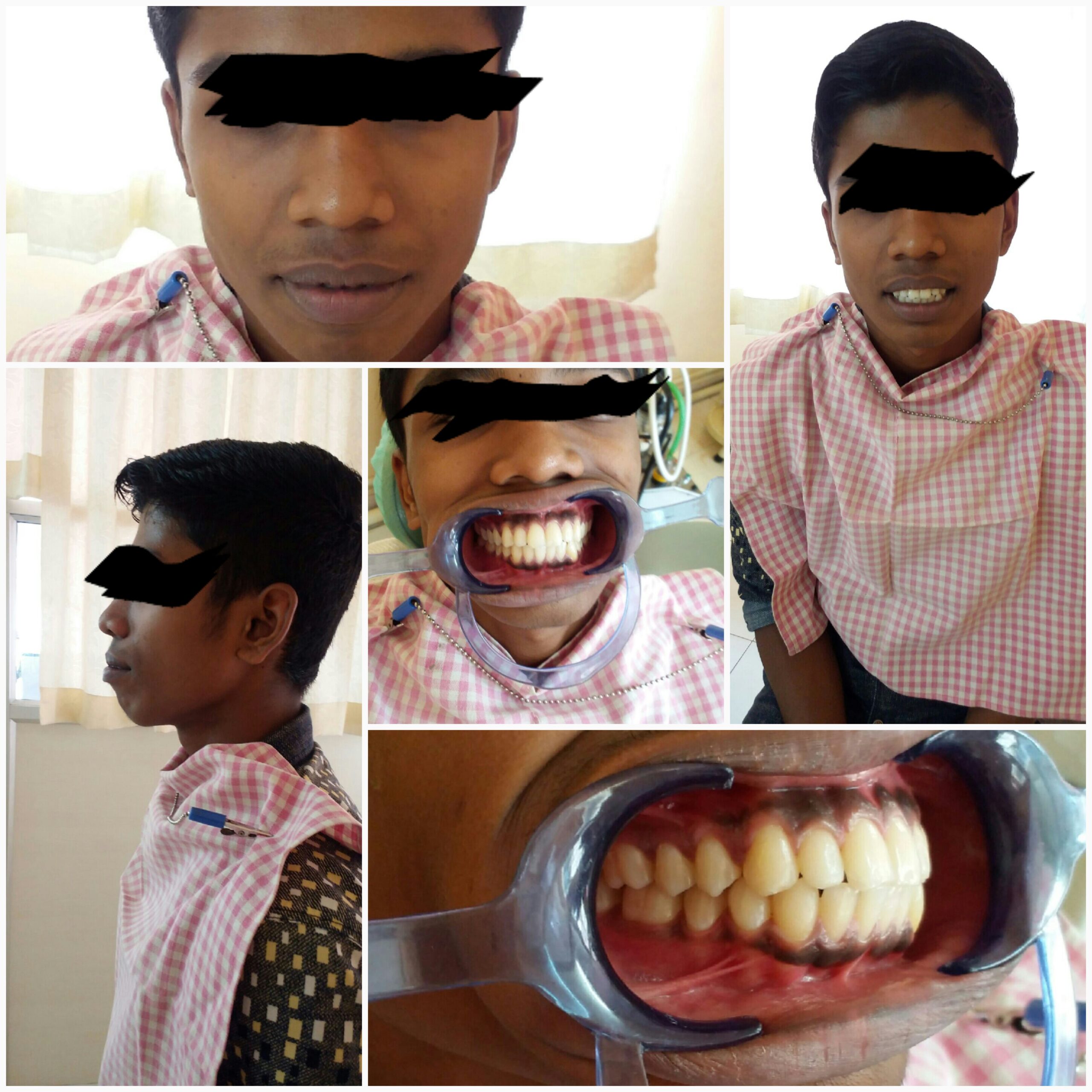 Before treatment