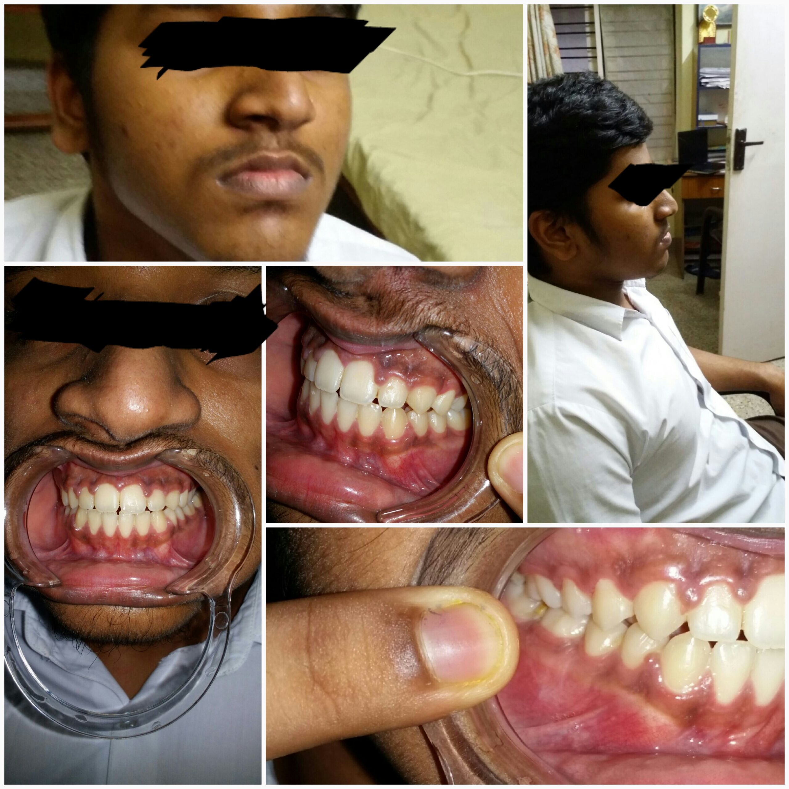 After treatment