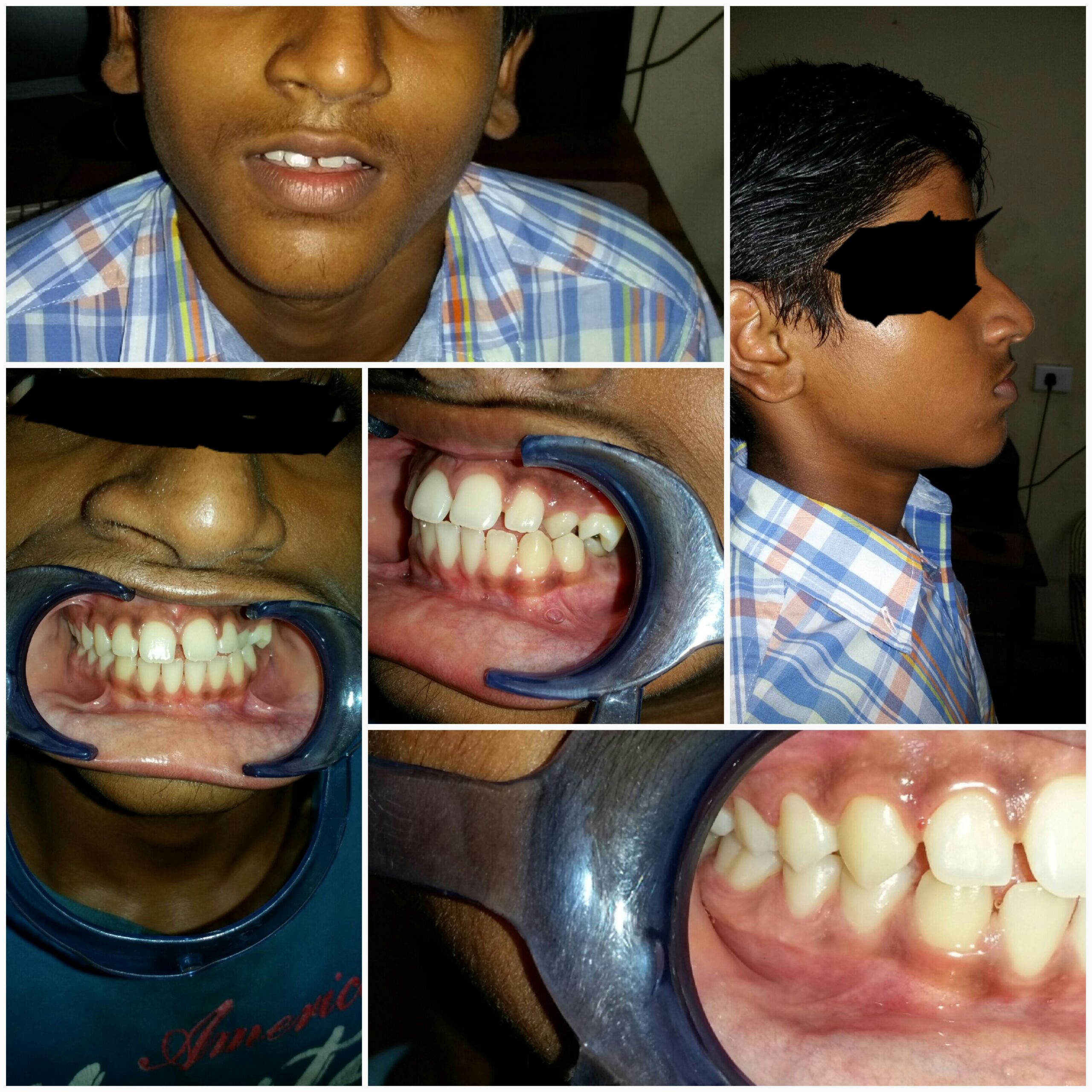 Before treatment