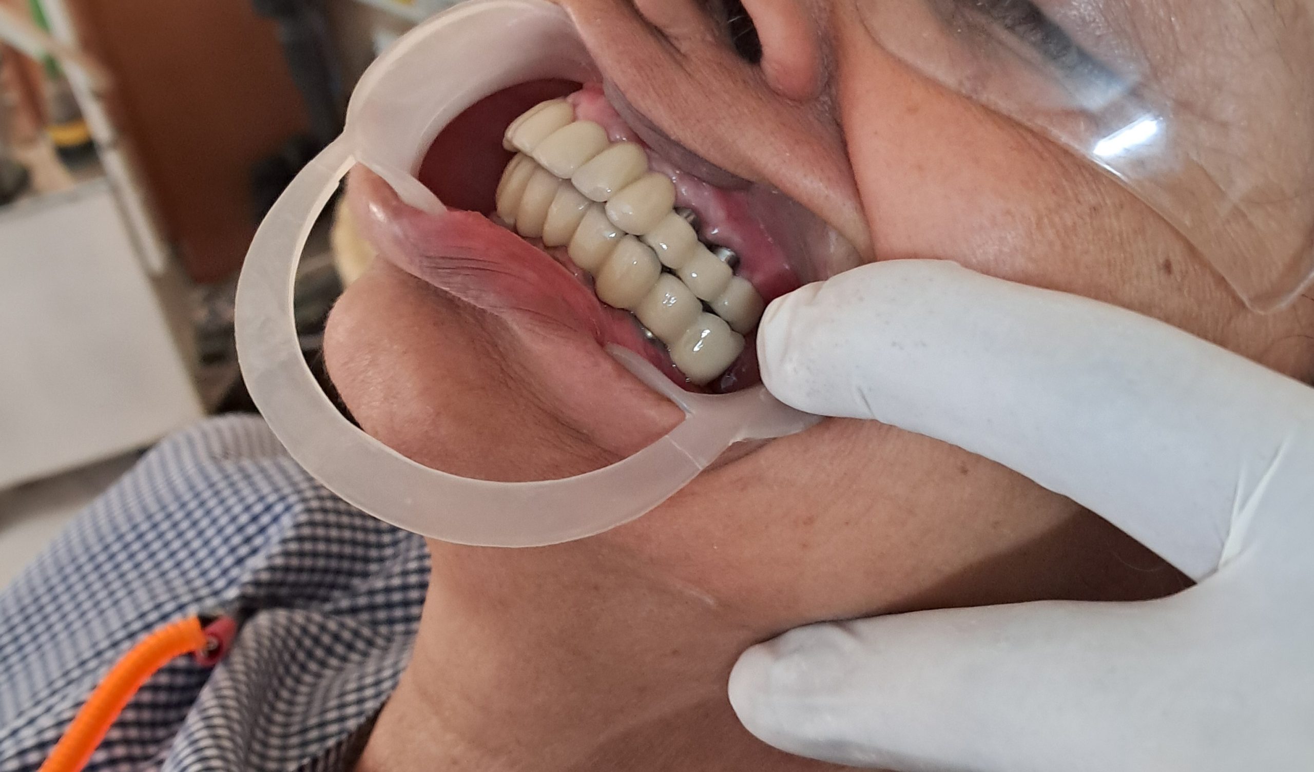 After treatment