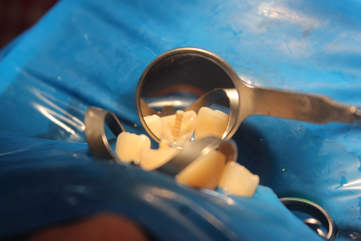 After treatment