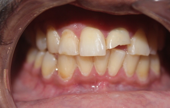 Before treatment