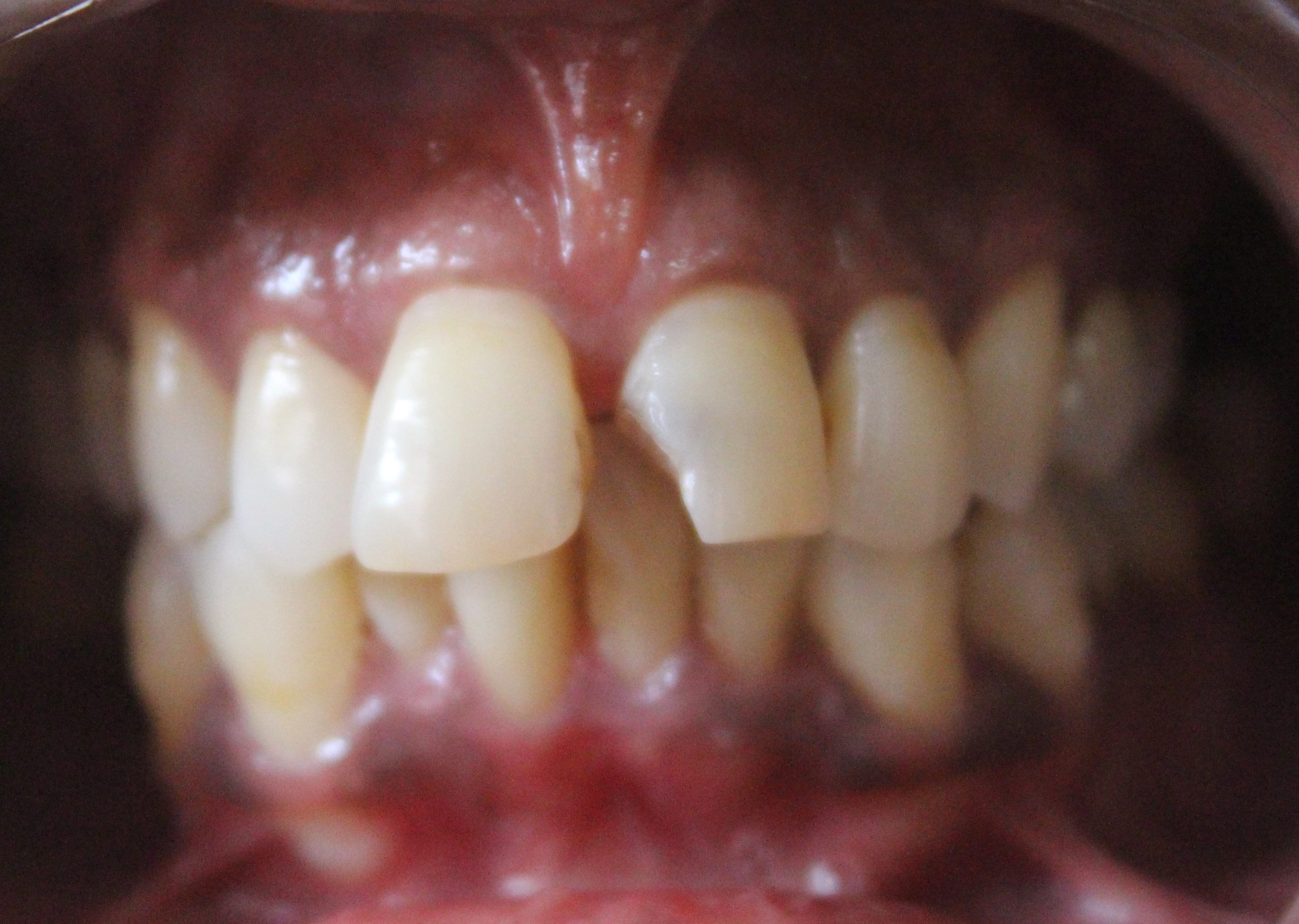 Before treatment