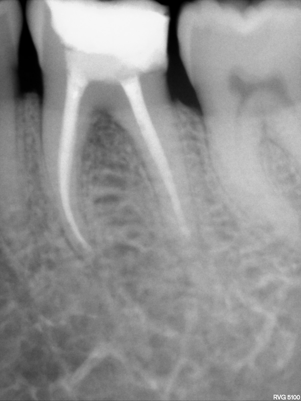 After treatment