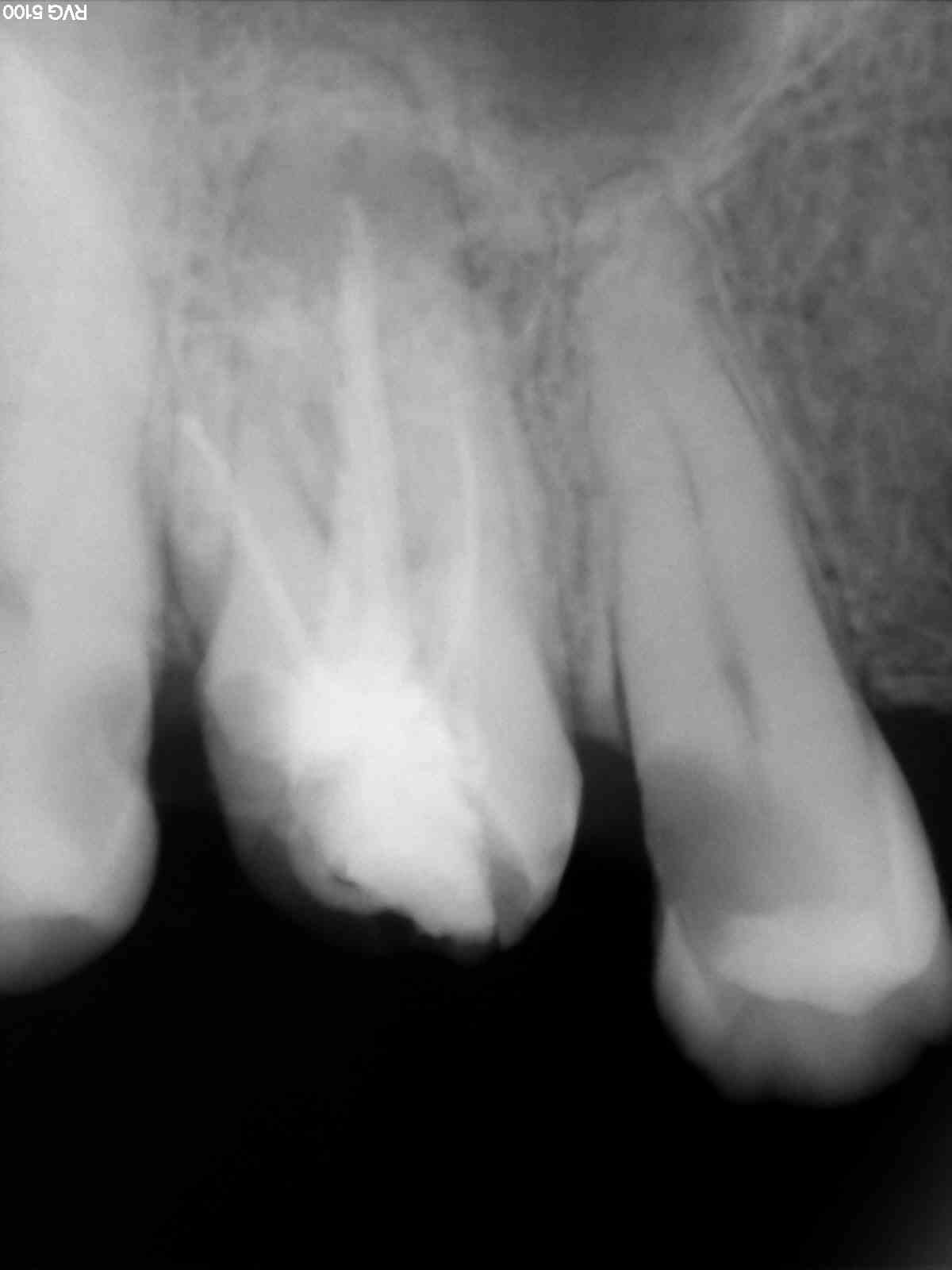 Before treatment